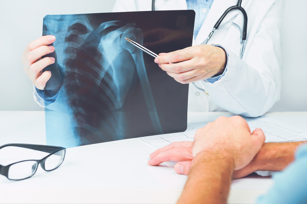 New Jersey Shoulder Injury Lawyer